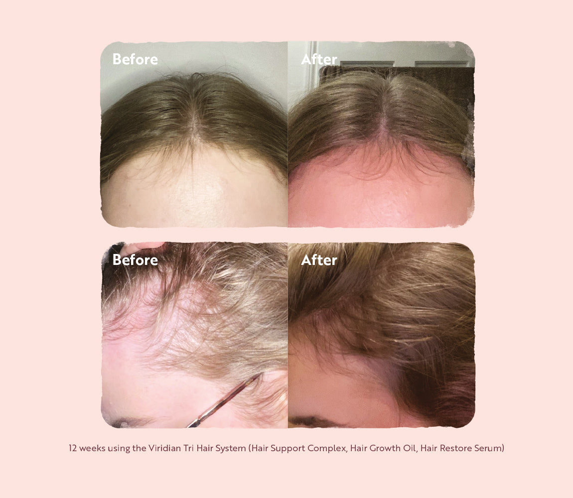 Tri-Hair System Box Set